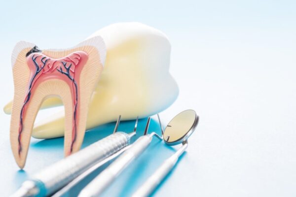 Do Dentists Lie About Root Canals