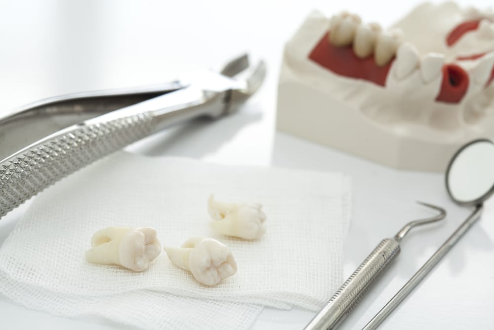 What are the stages of healing after tooth extraction